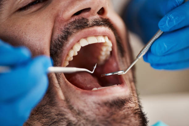 Best Same-Day Emergency Dental Services in Gallitzin, PA